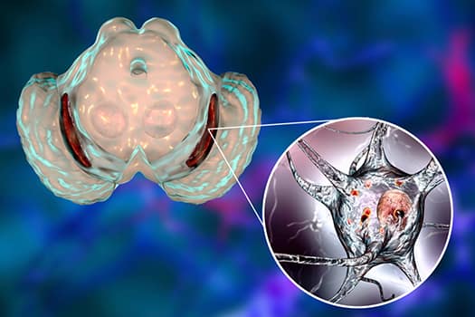 Prevention of Parkinson’s Disease