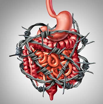 How to Naturally Prevent and Relieve Irritable Bowel Disease