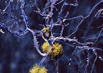 Prévenir la maladie d’Alzheimer