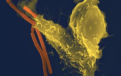 How to improve your immune system
