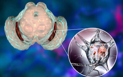 Prévenir la maladie de Parkinson